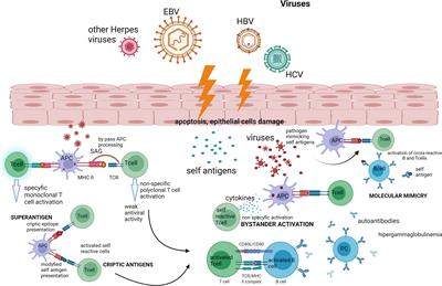 The role of virus infections in Sjögren’s syndrome